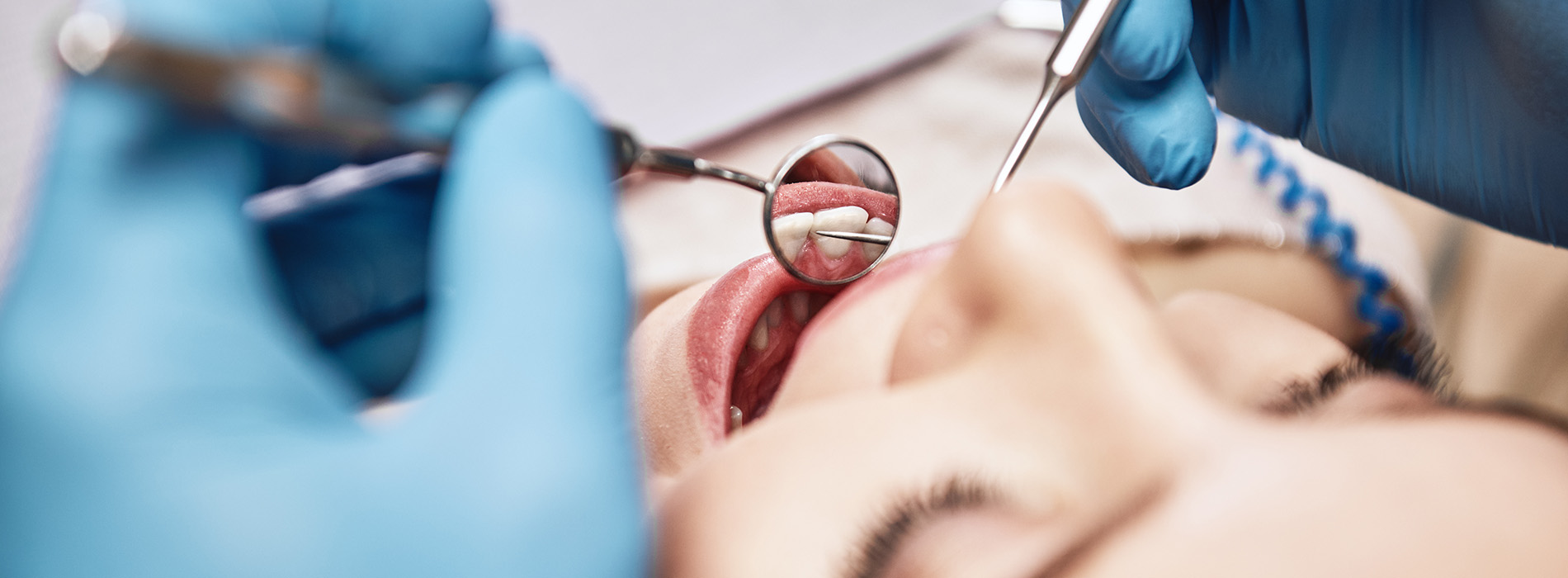 Brian J. Rosen, DDS | Dental Fillings, Air Abrasion and Teeth Whitening