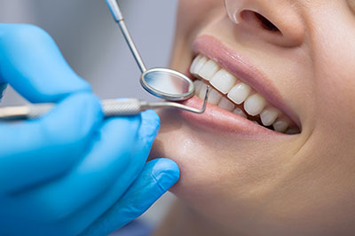 A dental professional performing teeth cleaning on a patient, with the patient s mouth open and the dental professional using specialized tools.