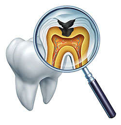 The image displays a magnified view of a human tooth with its root system and an oral cavity, featuring a tongue depressor with a transparent window through which the internal structure of the tooth is visible.