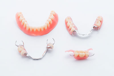 The image shows a collection of dental appliances, including braces and retainers, displayed against a white background.