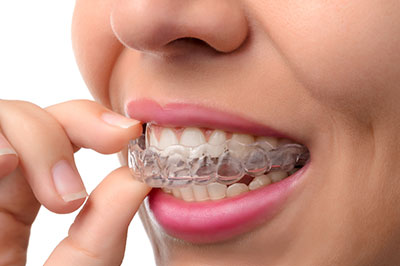 A person wearing clear braces and holding a toothpaste tube near their mouth.