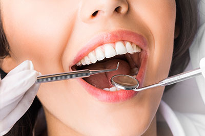 A woman with a wide smile, receiving dental care from a dentist.