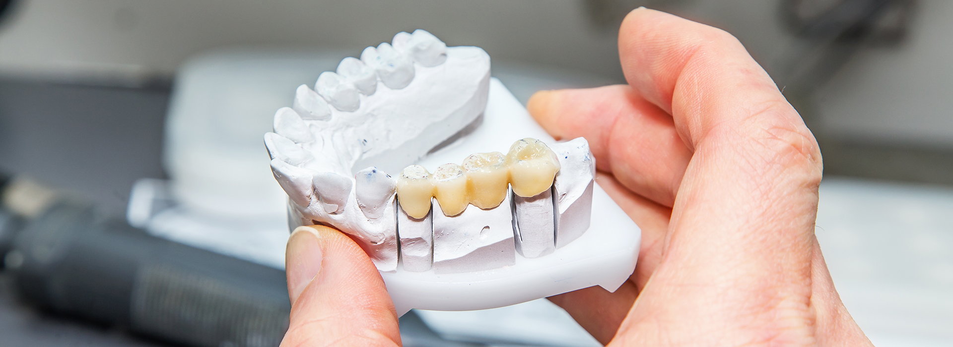Brian J. Rosen, DDS | Extractions, Invisalign reg  and Oral Cancer Screening