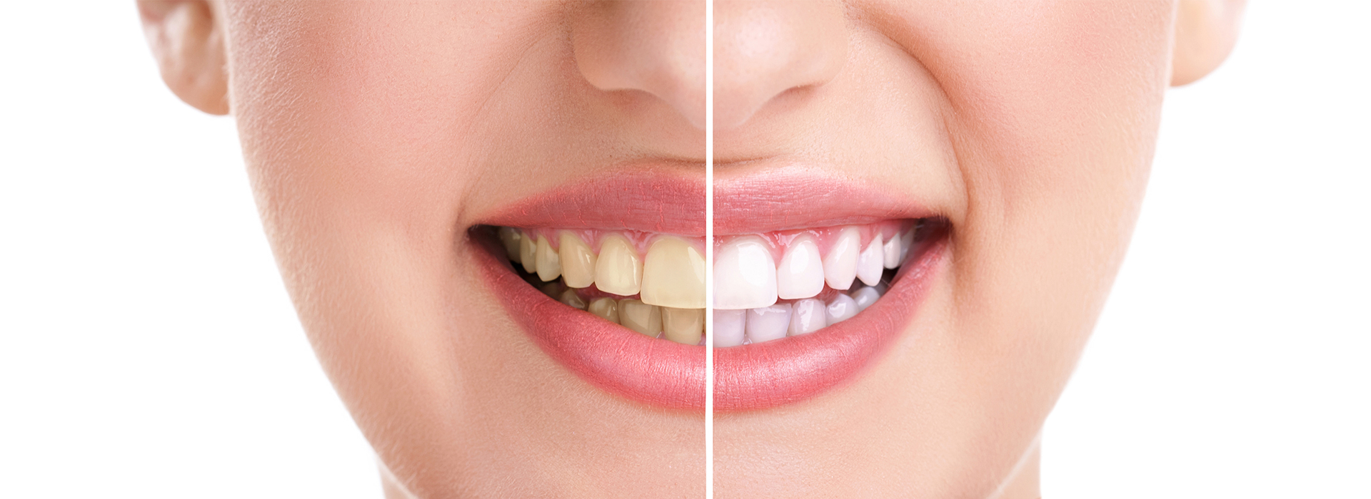 Brian J. Rosen, DDS | Dentures, Veneers and Implant Dentistry