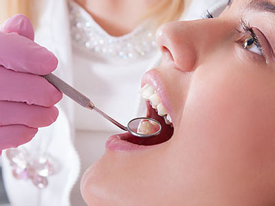 A dental professional performing a procedure on a patient s mouth.