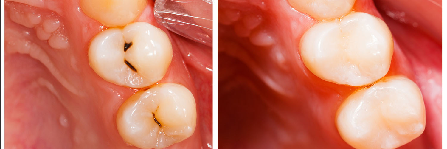 Brian J. Rosen, DDS